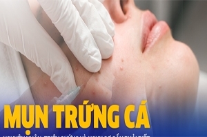 Đơn điều trị trứng cá - Mụn bọc