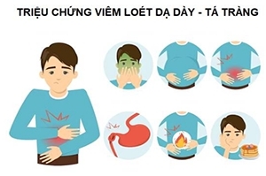 Đon thuốc Bệnh viêm loét dạ dày tá tràng