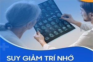 Đơn thuốc điều trị suy giảm trí nhớ